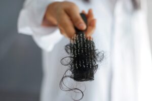 Spazzola piena di capelli caduti